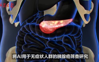 抗疫的新科技 攻克胰腺癌早筛难题，阿里AI模型获国际“突破性医疗器械”认定
