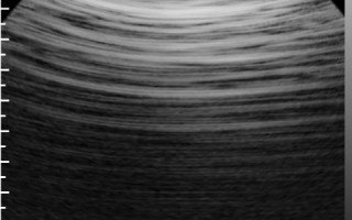 用手机做b超的软件下载 一键三连！鸿蒙原生版哔哩哔哩超好用，网友直呼B站这波上大分！